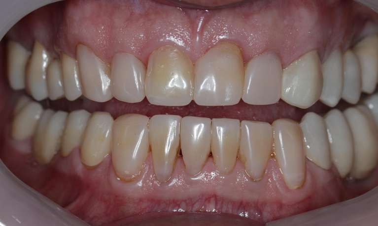 Patient-A-After-Image