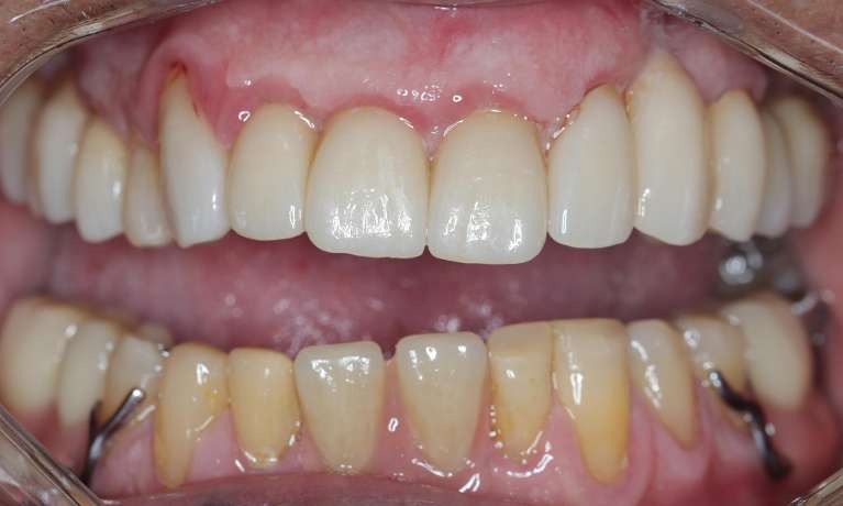 Patient-B-After-Image