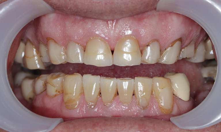 Patient-A-Before-Image