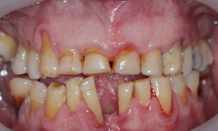 Patient-B-Before-Image